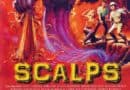 Scalps 1