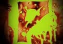 Pemphigoid 1