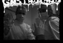 Gastroschisis 1