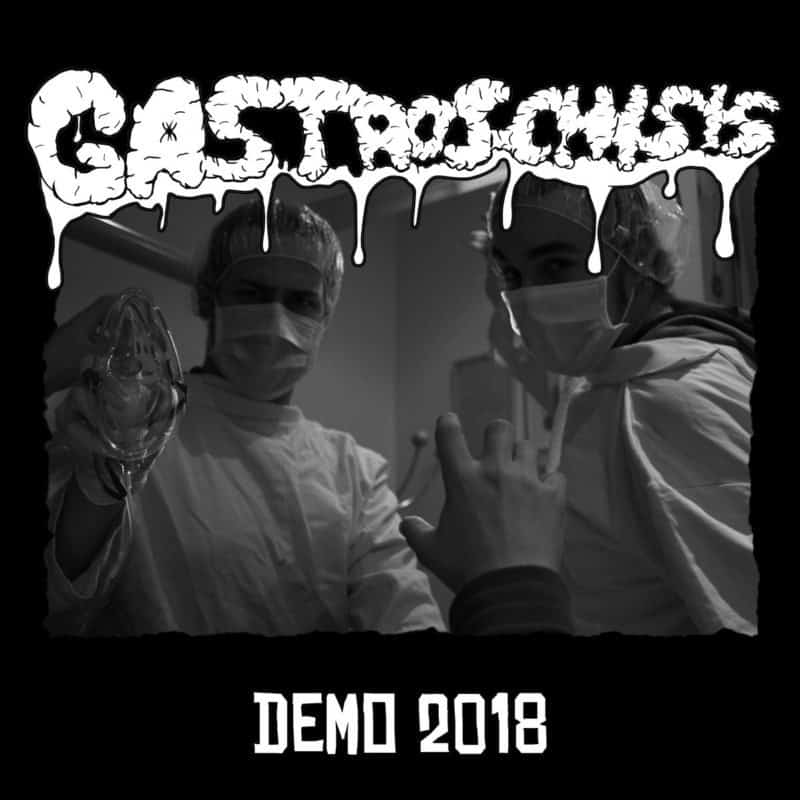 Gastroschisis 1