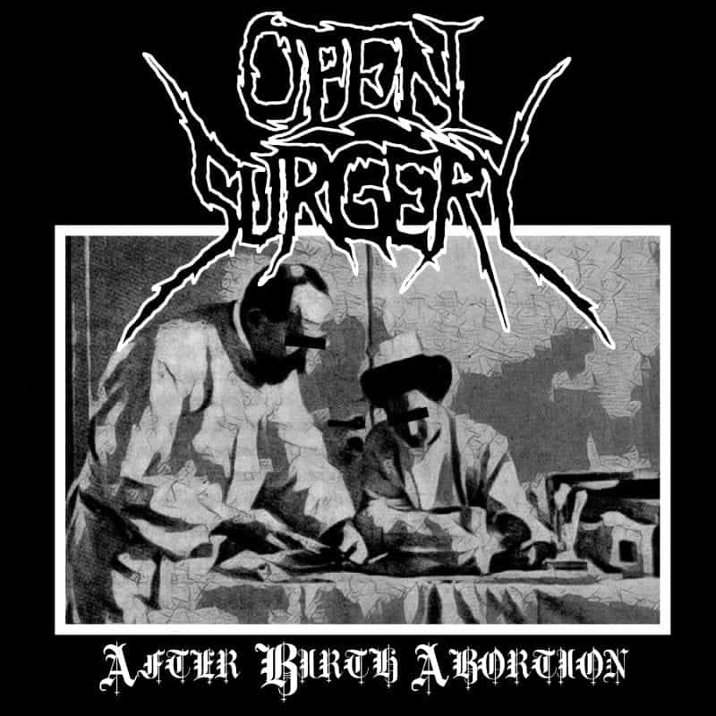 Open Surgery 1
